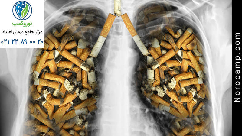 سرطان ریه از عوارض اعتیاد به سیگار